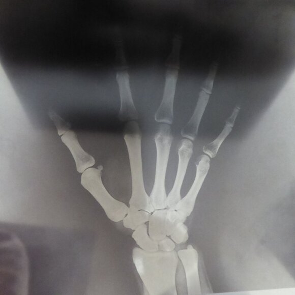 6” x 4” 24 HALLOWEEN ACETATE PLASTIC PAPER X-RAY IMAGE PAD - Picture 5 of 10